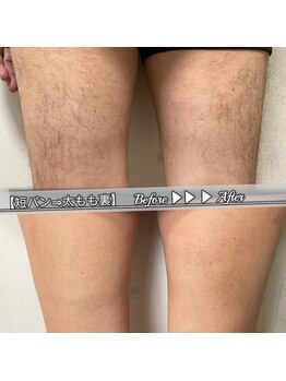 ブラックスワン(Black Swan)/