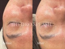 プレジール(plaisir)/お肌のツヤ、キメ改善！