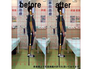 よし鍼灸接骨院 東花園院/施術効果【整体/骨盤矯正/大阪】