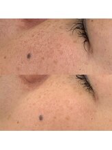 ビーカーブス 三鷹(B.curves)/before・after