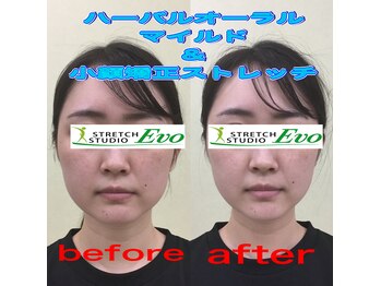 ストレッチスタジオ エボ(EVO)