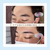 ノンプレックス(NON PLEX)