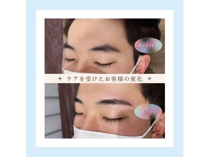 ノンプレックス(NON PLEX)の写真