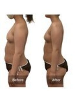 ベンザイ 新潟店(BENZAI)/最近体重が増えて悩んでる人