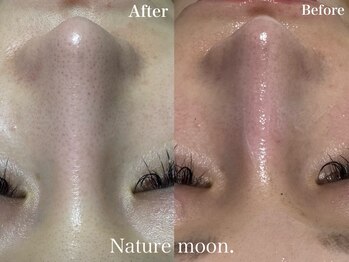 ナチュールムーン(Nature moon.)/毛穴洗浄