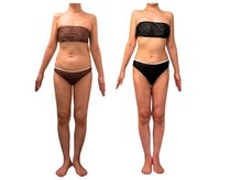 フィニシオン/50代6ヶ月後　O脚も見事改善