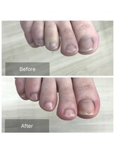 ドクターネイル爪革命 北千住店/トータルフットケア