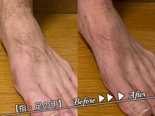 ブラックスワン(Black Swan)/