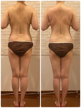 うつくし痩身 美サロン ゼットワン(Z-ONE)/メディセル＋パイラソード90分