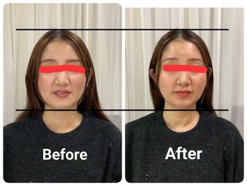 プピレ(pupille)/施術1回目、BEFORE、AFTER☆