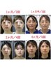 ※効果保障あり※ 616,000→300,000【身体と顔の悩み全て改善】総合施術14回