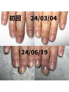 ホームケアとサロンケアで激変