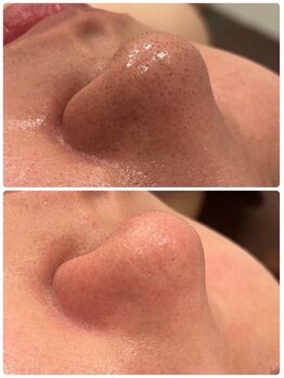 ルクシア(Luxia)/美容液洗浄