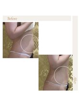 アイ アンド ネイル(Eye＆Nail Day)/寝ているだけで筋肉量MAX♪