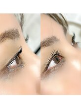 マーリエ(malie)/☆モンテラッシュリフト☆