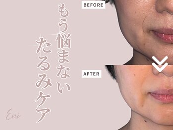 エニ(Eni)/マリオネットラインにアプローチ