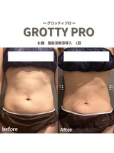 フルアナ(Hu ruana)/痩身/ダイエット/筋膜リリース