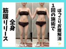 マーブル/全身筋膜リリース