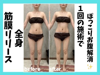 マーブル/全身筋膜リリース