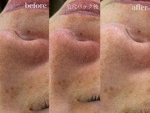 テオリア(TEORIA)/