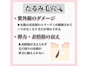 ホワイトアクア 天王寺本店(WHITE AQUA)/ハーブピーリング/大阪/天王寺