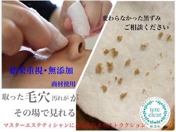 デアマリス/毛穴マスターエステティシャン