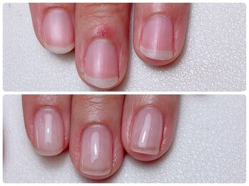 寺子屋ビューティーズ(寺子屋Beauty's)/自爪育成で変わりませんか？