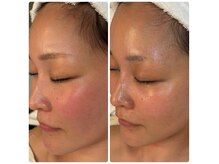 リベレ(Libelle)の雰囲気(ツヤツヤなお肌へ導きます♪)