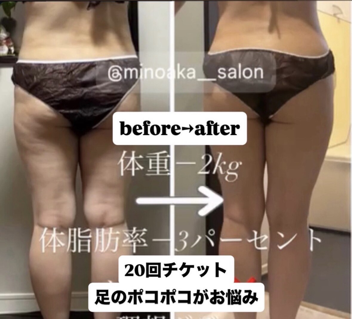 ヨサパーク ミノアカ(YOSA PARK MINOAKA)｜ホットペッパービューティー