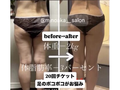 ヨサパーク ミノアカ(YOSA PARK MINOAKA)の写真