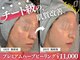 アール(ar.)の写真