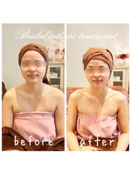 デジール(DESIR)/小顔×美しくデコルテライン