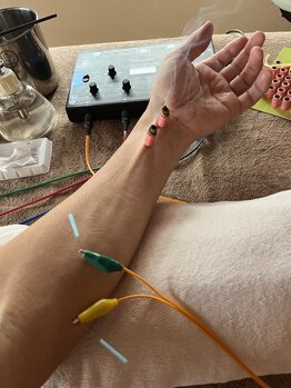 ライズ/腕への施術