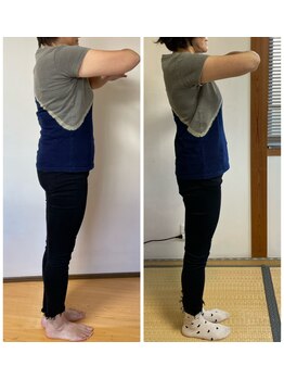 リンドール(RinDoll)/50代女性ダイエット/耳ツボ/痩身