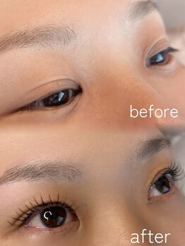 エント(Ento)/エクパ☆＆healthy☆