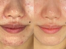 シェリル 出雲店(CHARIRE)