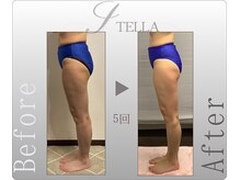 ステラ(STELLA)/下半身プレミアムの効果