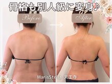 マリスステラ 天王寺(MarisStella)/2ヶ月で骨格からチェンジ！