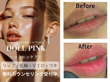 モンロー(MonroE+)/黒ずみ・くすみ・色素ケア