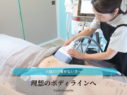 エノアシュエット(Enoachouette)の写真