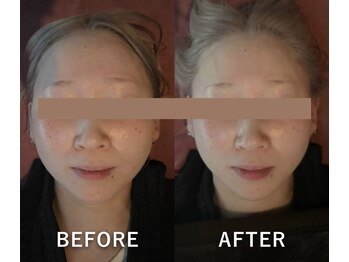 ミシェル(Michell)の写真/人気No1《小顔×骨盤矯正》お身体やお顔の歪み、たるみ等のお悩み解消！人から気づかれる結果重視コース
