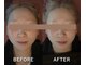 ミシェル(Michell)の写真/人気No1《小顔×骨盤矯正》お身体やお顔の歪み、たるみ等のお悩み解消！人から気づかれる結果重視コース