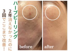 エリン(ERIN)の雰囲気（内側からハリ潤いのあるツヤ肌へ☆素肌は変わります♪）