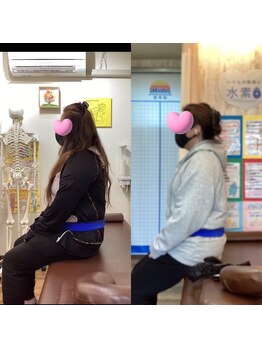 ヒデ整体院(Hide整体院)/１ヶ月後B/A　猫背矯正骨盤矯正