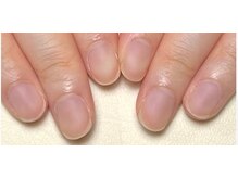 ラピシア(Rapicia)/