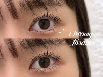 アイビューティートロント(i beauty Toronto)