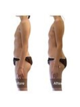 ベンザイ 新潟店(BENZAI)/腰が重い、体が重い、片頭痛