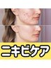 【喜びの声続出】ニキビケアフェイシャル &nbsp;&nbsp;8800円