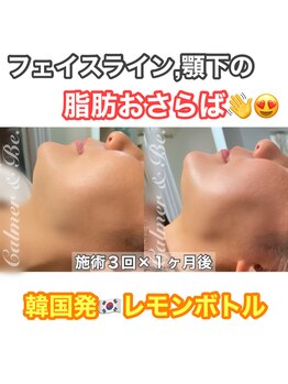 カルマーアンドビー(Calmer & Be.)/【レモンボトル】Before/After