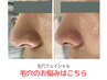 【毛穴洗浄エステ】/詰まり・汚れ・黒ずみ・引き締め改善！70分コース
